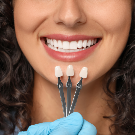 Patient holding up a dental shade guide guide to her teeth